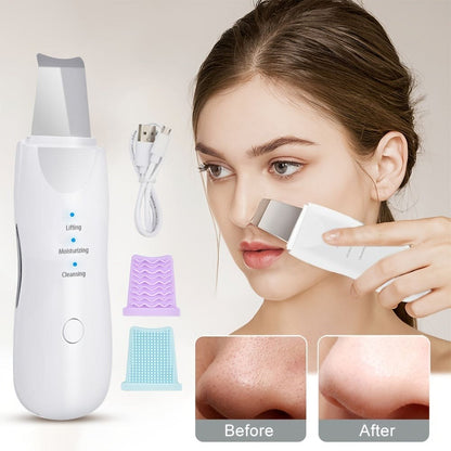 GlowWave Ultrasonic Skin Scrubber: Reveal Your Radiance