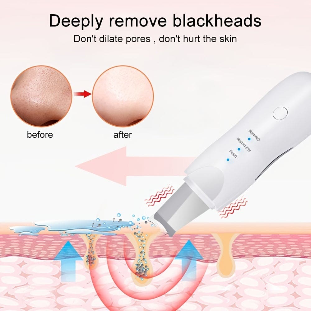 GlowWave Ultrasonic Skin Scrubber: Reveal Your Radiance