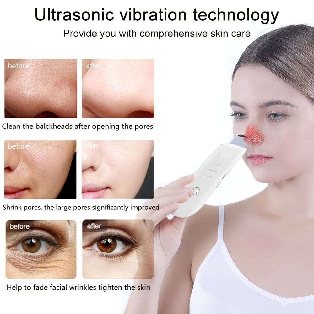 GlowWave Ultrasonic Skin Scrubber: Reveal Your Radiance